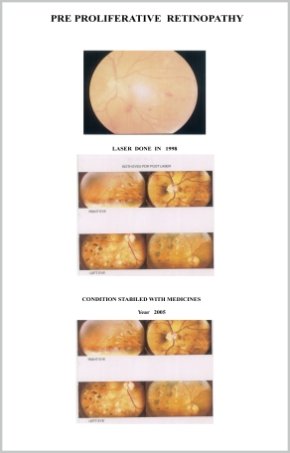 Diabetic Retinopathy